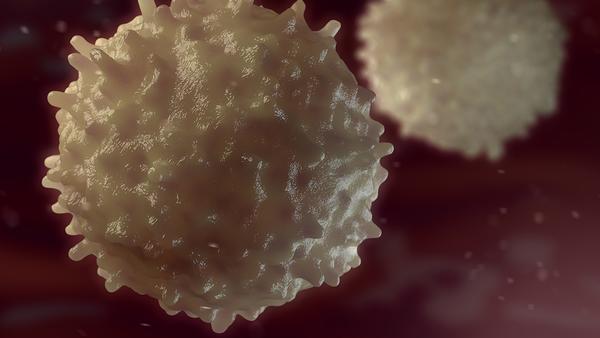 松果体细胞瘤
