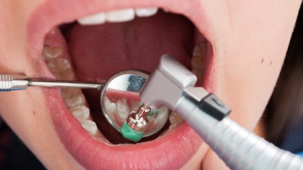 24岁男子烂牙3颗未治，感染大脑！烂牙危害究竟有多大?